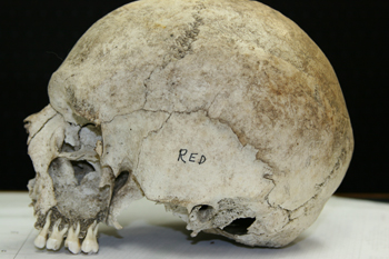 phskull2