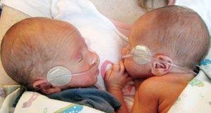Joshua and Lindsey Allred of Rangely, Colo., announce the birth of their twin sons, Andrew Joshua and Zachary Donald. The boys were born Jan. 27, 2015, in Grand Junction, Colo., at St. Mary’s Hospital. Zachary Donald was born at 12:35 a.m. and weighed 4 pounds, 4 ounces, measuring 17-3/4 inches long. Andrew Joshua was born at 12:36 a.m. and weighed 4 pounds 4 ounces, measuring 18 inches long. Maternal grandparents are Don and Phyllis Myers of Hamilton, Colo. Maternal great grandmother is Naomi Durham. Paternal grandparent is MaryAnn Allred of Rangely.